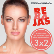 LASER FACIAL 3X2