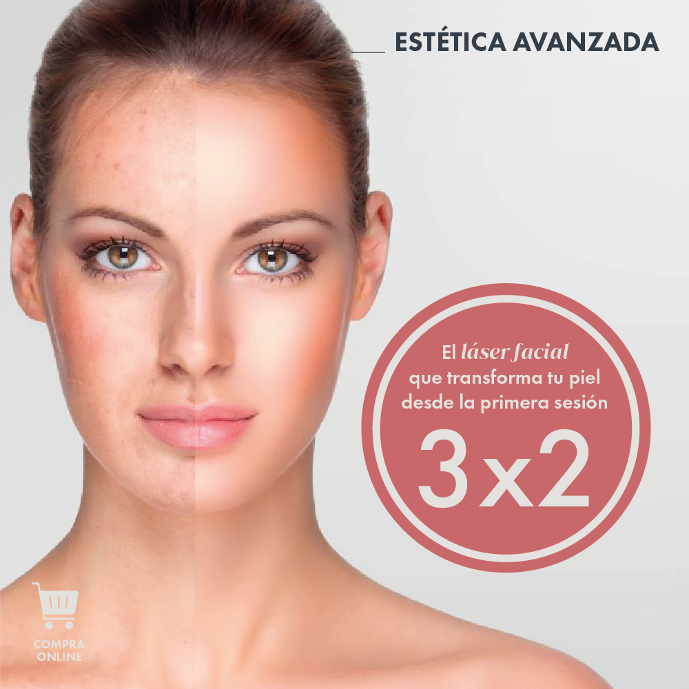 LASER FACIAL 3X2