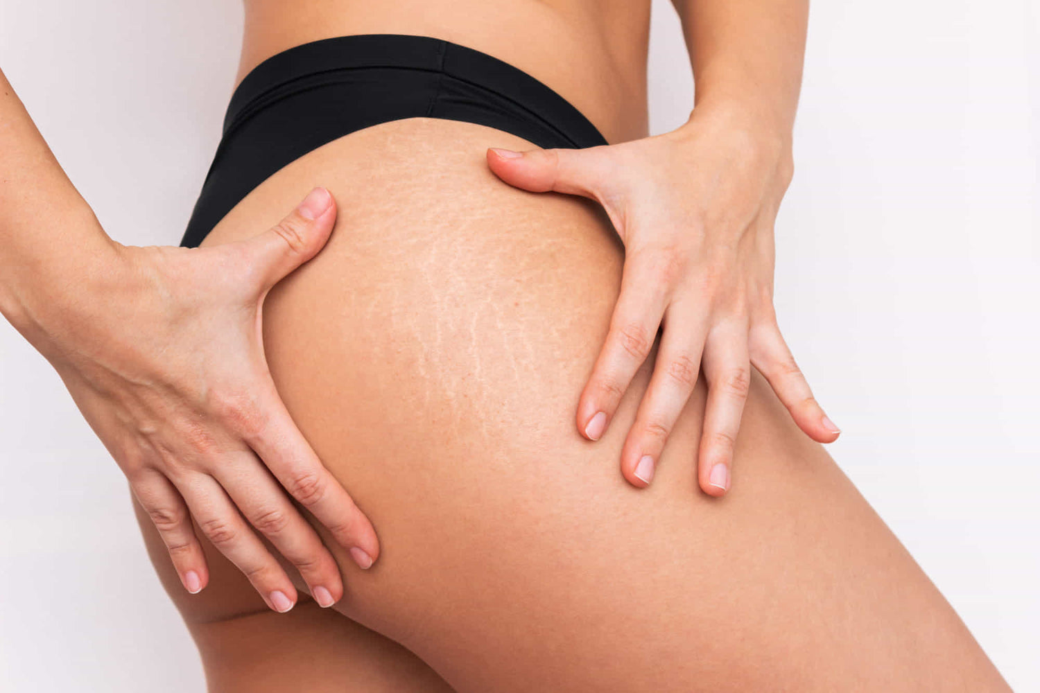 Bioestimulador de colágeno pro-age corporal en Alcalá de Henares con Polinucleótidos